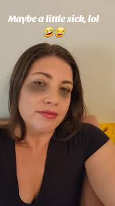 #fyp #funny #notsick #hungry