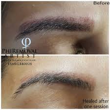 Just press a piece of the tape onto the tattoo and then slowly. Eyebrows Removal Procedure Eyebrow Tattoo Removal Laser Tattoo Removal Tattoo Removal Cost