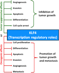 These blood vessels supply the tumor with nutrients and facilitate its metastatic spread. Emerging Evidence For Kruppel Like Factor 4 Klf4 As A Tumor Suppressor In Neuroblastoma Sciencedirect