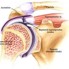 What Is The Supraspinatus Tendon Ehow Rotator Cuff Shoulder Surgery Shoulder Anatomy