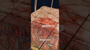 Image result for Diascopy