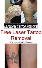 Aside from following your artists instructions for how to best heal their style of tattooing, there are a few. Pin On Tattoo Removal