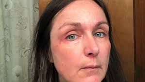 Fundraiser for Heather Zampogna by Heather Collea : Helping Heather Z Fight  Leukemia