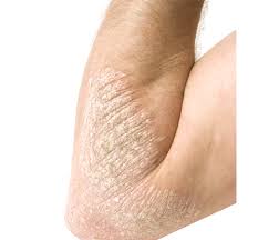 Emergency can strike anyone at any point of time. Best Dermatology Hospitals In Hyderabad India Care Hospitals