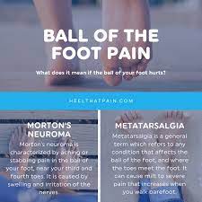 Pin On Heel That Pain Blog