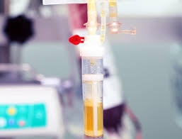 Image result for Plasma Transfusion