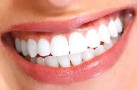 How long do veneers last? The Answer To How Long Do Veneers Last Gregg L Lage Dds Pc Denver Colorado