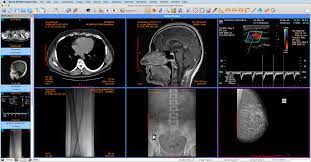 Using dicom viewer mac free download crack, warez, password, serial numbers, torrent, keygen, registration codes, key generators is illegal and your business could subject you to lawsuits and leave your. Sante Dicom Viewer Mac Santesoft Ltd