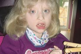 Parents in plea to help Natasha Falls take first steps