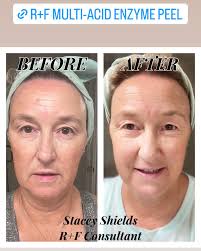 Stacey Shields Skincare