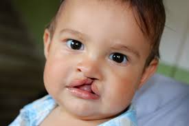 Image result for "Yuko Yamaguchi" age