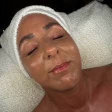 🚨 FINAL DAYS! The POLY50 code for 50% OFF Polynucleotides ends in just 3  days — and it's never coming back. ✨ You can book appointments for future  dates 💉 You can