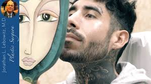 Tear Trough Filler To Fix A "Tired" Face At Lebowitz Plastic Surgery  Huntington Long Island New York