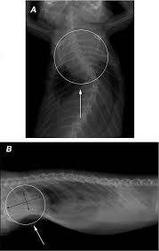 Most of the time, it is caused by an infection that reaches the heart. Survey Thoracic Radiographs Cardiomegaly Is Present Arrows A Download Scientific Diagram