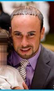 What Would You Even Call This Comb Over Anime Get You Free Listing And Advertise Hair News Network All Hair All The Tim Going Bald Hair Humor Comb Over