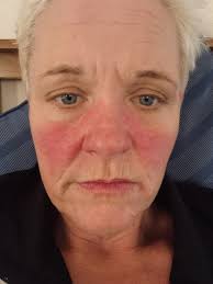 This muscle pain hurts so bad