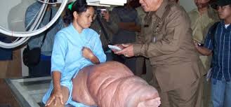 Check spelling or type a new query. Karawang Endemis Penyakit Kaki Gajah Republika Online