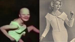 This Woman Voluntarily Felt Victim to Terrible Experiment ABIGAIL ...