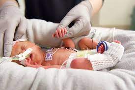 Jul 13, 2020 · neonatologist salary and other compensation nationwide, neonatologists earn an average annual salary of $255,038, according to a june 2020 report on salary.com. New Normal In Neonatology University Of Iowa Stead Family Children S Hospital