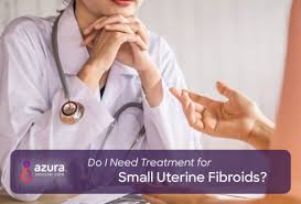 Understanding Uterine Fibroid Size How Big Is Too Big
