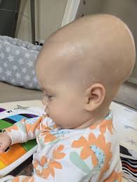 EXTRA SPECIAL BONUS THIS DAY IN GLUNT HISTORY(39 years ago) 5-15-1979: An  infant is born in Rochester, New York to Daniel Glunt and Sheila Petrulli  Yalich. The child has an adult sized