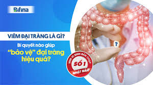 Về hình dạng, trực tràng có hình xích ma ở đầu và càng về sau càng. Viem Ä'áº¡i Trang La Gi Bi Quyáº¿t Nao Giup Báº£o Vá»‡ Ä'áº¡i Trang Hiá»‡u Quáº£