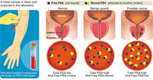 Image result for Free PSA