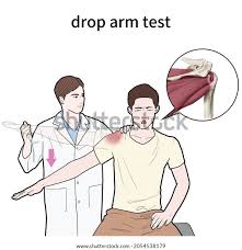 Image result for Drop Arm Test