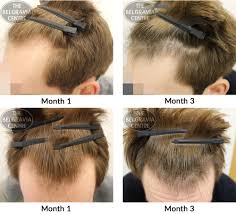To grow your hair to this length, starting with a chin length look would take about 20 months considering the average hair growth of 0.5 inch per month. Hair Growth Success Absolutely Ecstatic With The Results