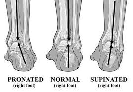 BSMSanatomy on Twitter: "Foot pronation/supination.Pron++=flat  feet,Sup++=high arches.Its midtarsal jt mvt vs in/eversion=SubTjt  #m204anatomy… "
