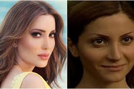 (لا يجوزُ إجراءُ جِراحةِ التَّجميلِ التَّحسينيَّةِ التي لا تدخُلُ في العِلاجِ الطِّبيِّ، ويُقصَدُ منها تغييرُ خِلقةِ الإنسانِ السَّوِيَّة تبعًا للهوى والرَّغَباتِ بالتقليدِ للآخَرينَ، مثل عمليَّات تغييرِ شَكلِ الوَجهِ للظُّهورِ بمَظهرٍ مُعَيَّنٍ، أو بقَصدِ التَّدليسِ وتضليلِ. Oiil6k3ue Cw9m