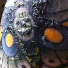 Don't worry, having a tattoo scab is pretty normal. Tattoo Scabbing How Much Is Normal And What Should You Do