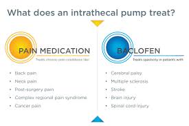 Image result for Intrathecal Pump