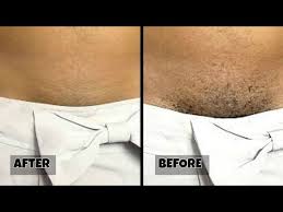 O.o i used to backshave in the opposite direction of the hairs on the sides of the lower shaft b4 i had this 'problem', as this kept it smooth. How To Grow Your Pubic Hair Long Thicker Fast Naturally Without Itching