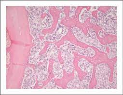 These include your blood pressure, heart rate and metab. Histologic Section Of An Osteoblastic Bone Metastasis In A Patient With Download Scientific Diagram