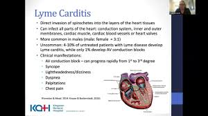 Image result for Lyme Carditis