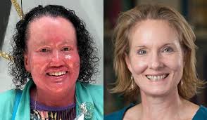 Who has the right to talk about the issues facing people with disability?