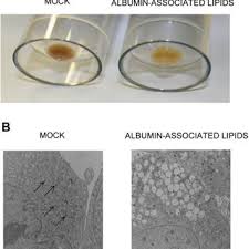 Pour a quart of whole milk into a glass or ceramic bowl (anything but metal). Pdf Transdifferentiation Of Malme 3m And Mcf 7 Cells Toward Adipocyte Like Cells Is Dependent On Clathrin Mediated Endocytosis