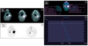 Guarda mary queen of scots streaming gratis film senza limiti sul nostro sito cb01 ex cineblog01. Frontiers Sunitinib Treatment For Advanced Paraganglioma Case Report Of A Novel Sdhd Gene Mutation Variant And Systematic Review Of The Literature Oncology