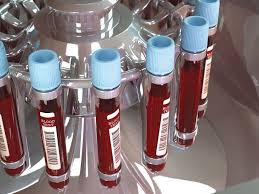 Image result for Plasma Transfusion