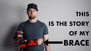 Surgeons typically perform tommy john surgery for patients who. The Brace You Re My Boy Blew Vlog Ep02 My Tommy John Surgery Brace Youtube