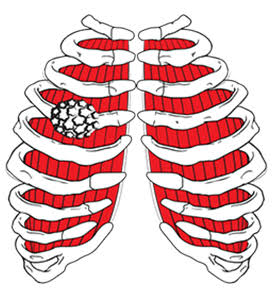 Chest CT imaging used in evaluation of chest wall tumours