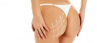 Quel que soit le type de votre intervention, augmentation il existe également des implants fessiers destinés aux hommes. Augmentation Fesses Tunisie Prix Implant Fesses Chirurgie Des Fesses