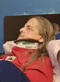 Any advice for calming a patient with a broken arm?