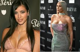 Kim Kardashian Plastic Surgery: True or False? Past vs Present Photos