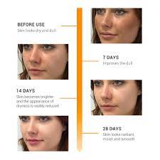 Specially formulated to provide nutritional support at every stage of life! Does Taking Vitamin C Lighten Skin Vitaminwalls