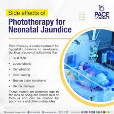 Image result for Phototherapy