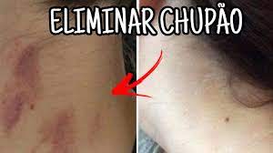 Como tirar chupao rapido