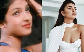 Priyanka Chopra Was Once Denied Films Because Of Her Nose Surgery Priyanka chopra has been trolled for her alleged 'nose job'.