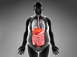 New Research Finds That With Obesity, the Problem Isn't an Excess ...